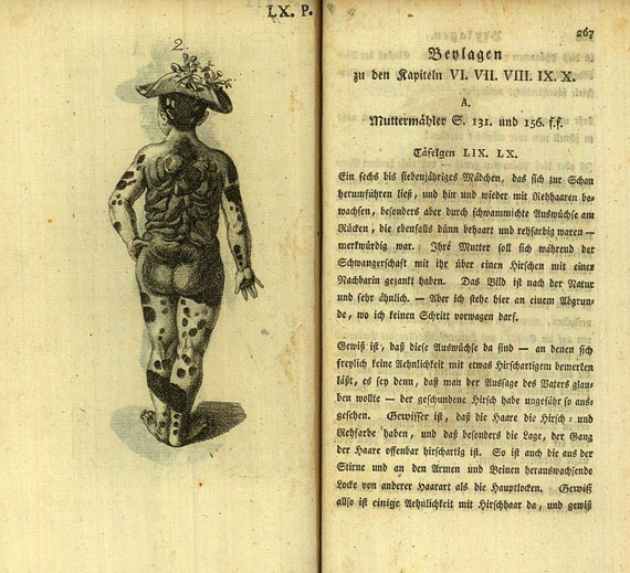 Johann Caspar Lavater - Physiognomische Fragmente. 4 Bde. 1783-1830